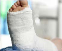  14 пациенти със счупени ръце и крака  в Спешното отделение  на „МБАЛ Русе”  АД