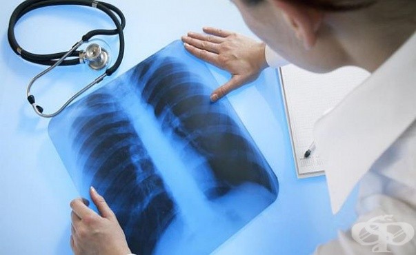Стартира кампания за безплатни изследвания с флуорограф за ранно откриване на туберколоза