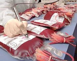 Търсят кръводарители за пациент със 70 % изгаряния, настанен в УМБАЛ „МЕДИКА РУСЕ“