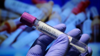 96 нови случая на коронавирус в страната