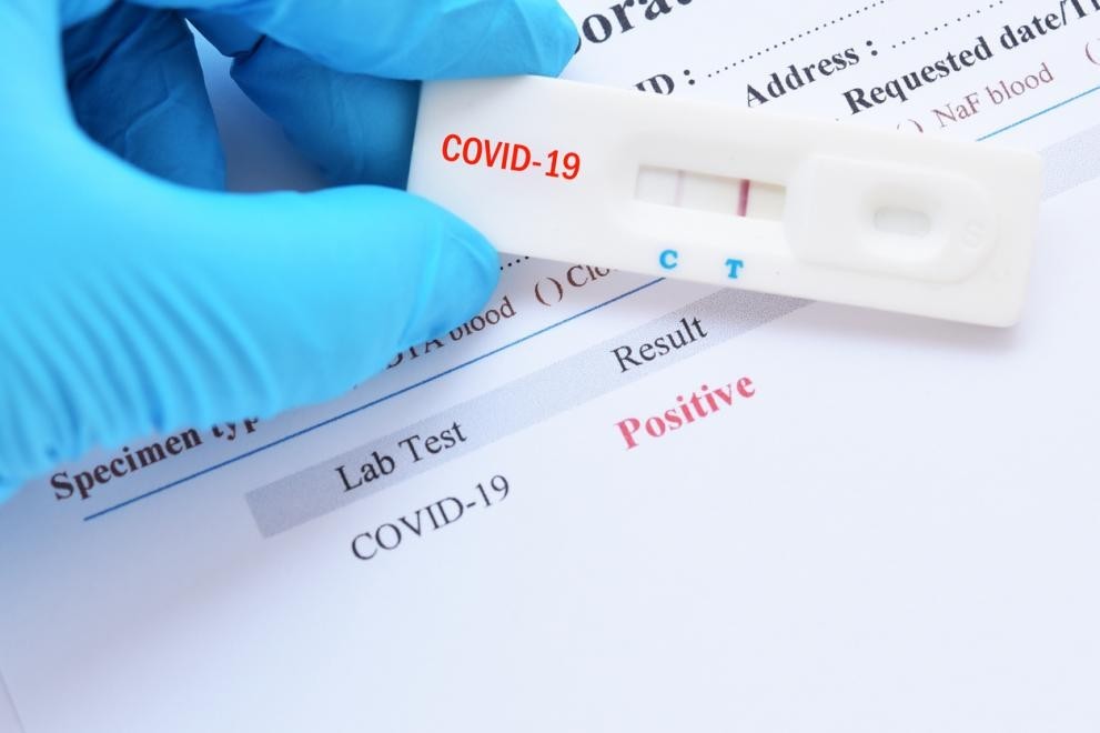Бързият антигенен тест прави тестването за коронавирус изключително достъпно